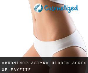 Abdominoplastyka Hidden Acres of Fayette