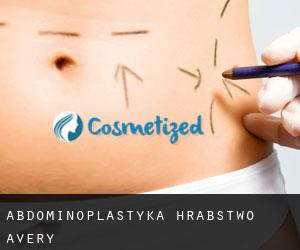 Abdominoplastyka Hrabstwo Avery