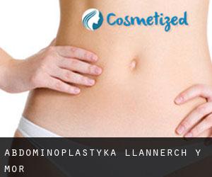 Abdominoplastyka Llannerch-y-môr