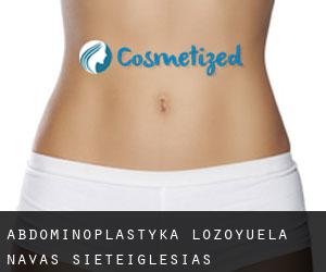 Abdominoplastyka Lozoyuela-Navas-Sieteiglesias