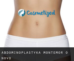 Abdominoplastyka Montemor-O-Novo