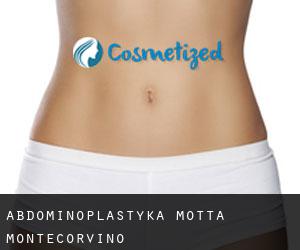 Abdominoplastyka Motta Montecorvino