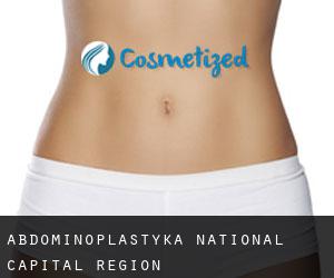 Abdominoplastyka National Capital Region