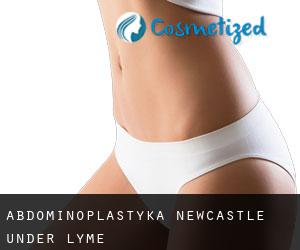 Abdominoplastyka Newcastle-under-Lyme
