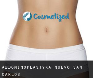 Abdominoplastyka Nuevo San Carlos