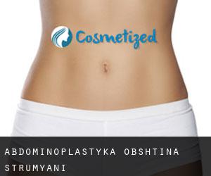 Abdominoplastyka Obshtina Strumyani