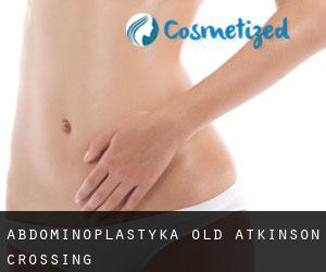 Abdominoplastyka Old Atkinson Crossing