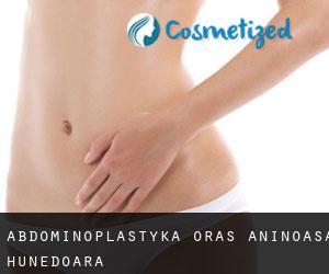Abdominoplastyka Oraş Aninoasa (Hunedoara)