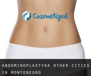 Abdominoplastyka Other Cities in Montenegro