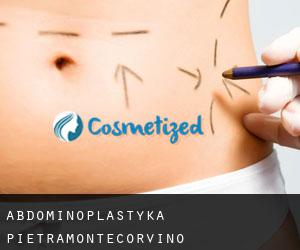 Abdominoplastyka Pietramontecorvino