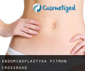 Abdominoplastyka Pitmon Crossroad