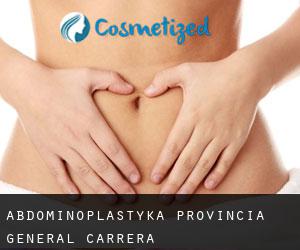 Abdominoplastyka Provincia General Carrera