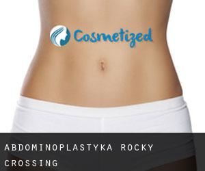Abdominoplastyka Rocky Crossing