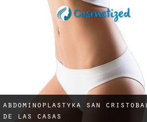 Abdominoplastyka San Cristóbal de Las Casas