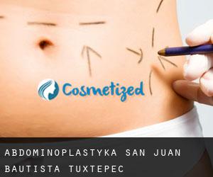 Abdominoplastyka San Juan Bautista Tuxtepec