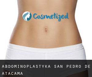 Abdominoplastyka San Pedro de Atacama