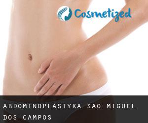 Abdominoplastyka São Miguel dos Campos