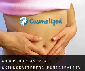 Abdominoplastyka Skinnskatteberg Municipality