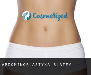 Abdominoplastyka Slatey