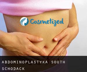 Abdominoplastyka South Schodack
