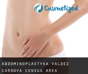 Abdominoplastyka Valdez-Cordova Census Area