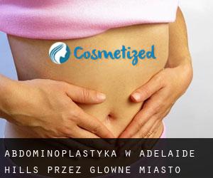 Abdominoplastyka w Adelaide Hills przez główne miasto - strona 1