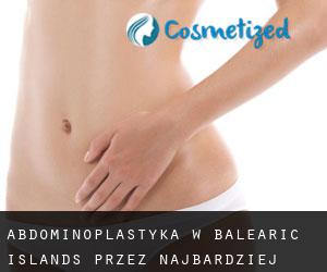 Abdominoplastyka w Balearic Islands przez najbardziej zaludniony obszar - strona 1