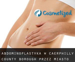 Abdominoplastyka w Caerphilly (County Borough) przez miasto - strona 1
