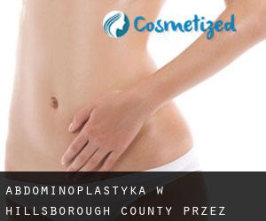 Abdominoplastyka w Hillsborough County przez miasto - strona 1