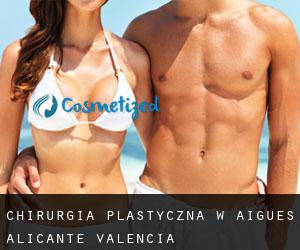 chirurgia plastyczna w Aigues (Alicante, Valencia)