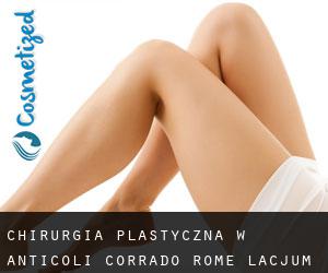chirurgia plastyczna w Anticoli Corrado (Rome, Lacjum)