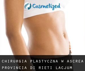 chirurgia plastyczna w Ascrea (Provincia di Rieti, Lacjum)
