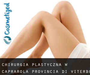 chirurgia plastyczna w Caprarola (Provincia di Viterbo, Lacjum)
