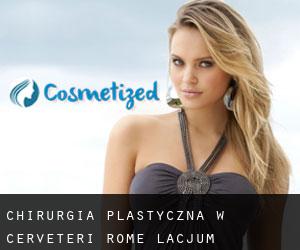 chirurgia plastyczna w Cerveteri (Rome, Lacjum)
