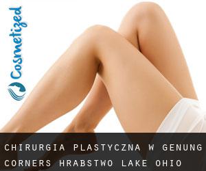 chirurgia plastyczna w Genung Corners (Hrabstwo Lake, Ohio)