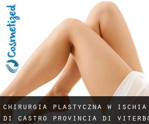 chirurgia plastyczna w Ischia di Castro (Provincia di Viterbo, Lacjum)