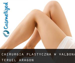chirurgia plastyczna w Valbona (Teruel, Aragon)