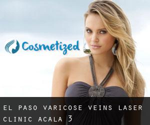 El Paso Varicose Veins Laser Clinic (Acala) #3