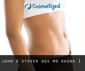 John D Stover, DDS, MD (Akona) #1